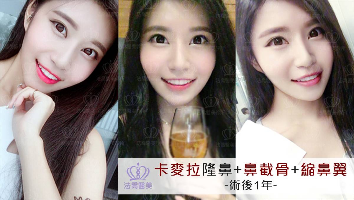 卡麥拉隆鼻,鼻截骨,縮鼻翼