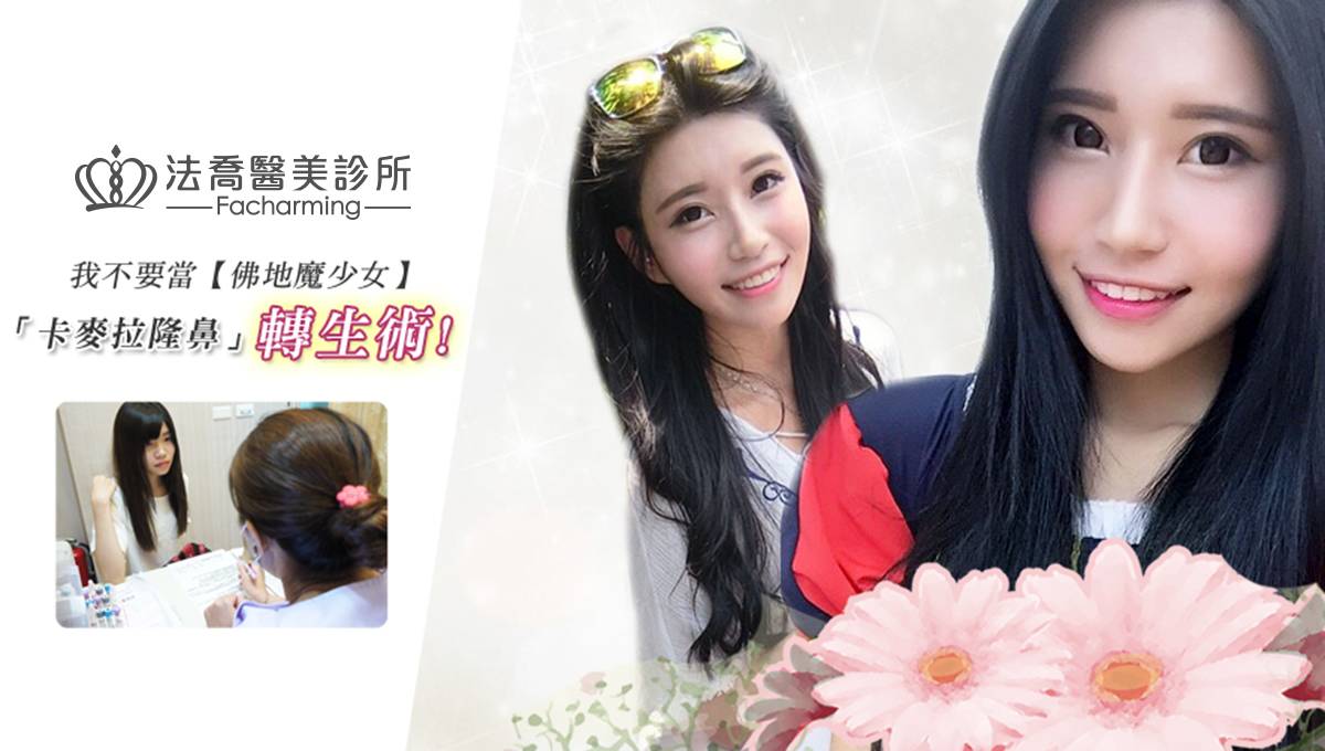 卡麥拉隆鼻,鼻截骨,縮鼻翼