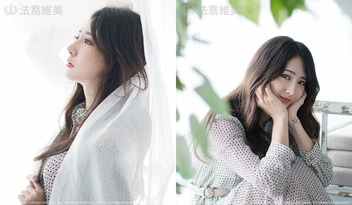 自體肋骨隆鼻,鼻截骨,術前畫線