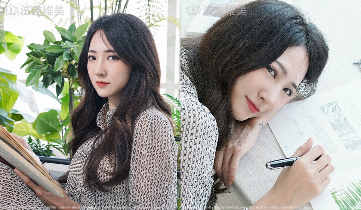 自體肋骨隆鼻,鼻截骨,術前畫線