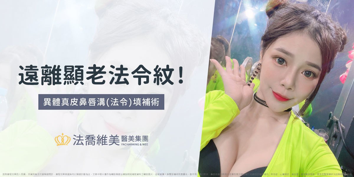 異體真皮鼻唇溝法令填補術,法令紋